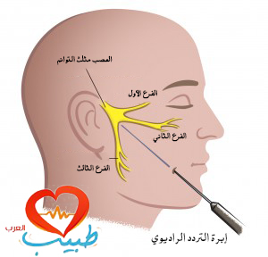 الام اعصاب الاسنان وعلاجها - معلومات خطيرة عن العصب في الانسان 20160707 745