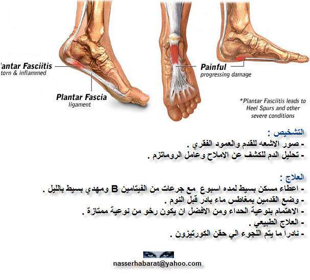 اعراض وعلاج املاح القدمين 20160619 565