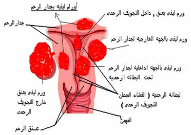 سبب عدم نزول الدورة - سبب هيدهشك عن عدم نزول الحيض 20160708 735