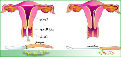 كيفية تنظيف الرحم بعد الدورة الشهرية 20160717 1371