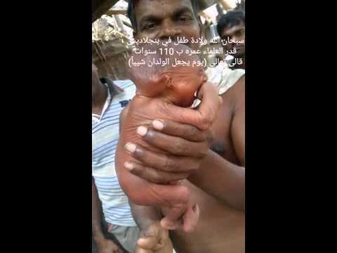 المراة التي ولدت طفل عجوز 20160629 2688