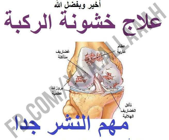 خشونة الركبة وعلاجها بالاعشاب - علاج الم خشونة الركبة طبيعي بدون جراحة 20160710 184