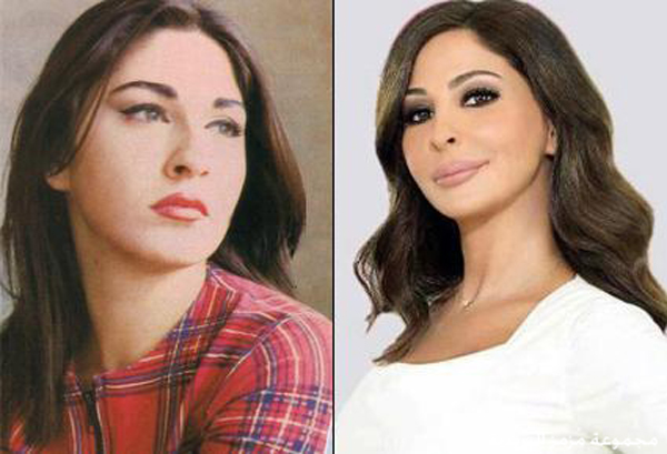 اليسا قبل عمليات التجميل