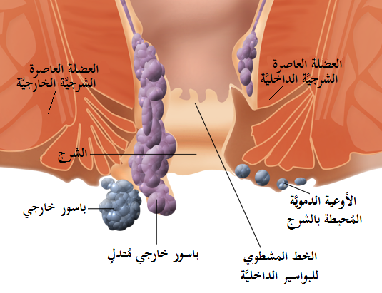 افضل مسكن لمرض البواسير