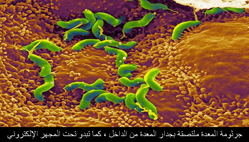 علاج جرثومة المعدة علاج جرثومة المعدة بالاعشاب و روشتة علاج - ادوية تقضي على جرثومة المعدة بجرعة واحدة 291Z0W8