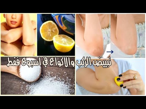 ركبي بقت بتلمع من جمالها - خلطات طبيعية لتبييض الركب 20160717 1033