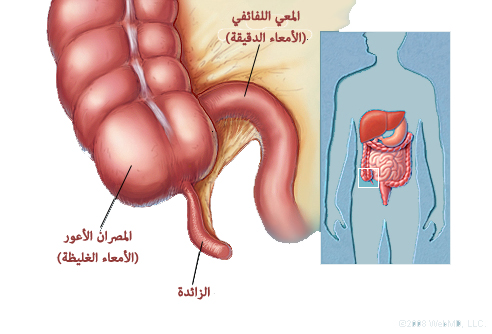 القولون دة طلع مزعج اووى , تعرف علي امراض القولون