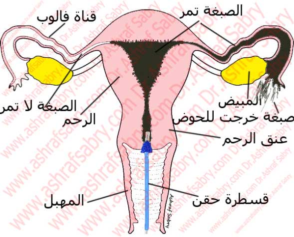 هل اشعة الصبغة تؤخر الدورة 20160703 1914