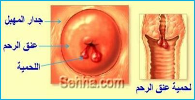 افرازات الرحم البيضاء اللزجة 20160713 1350