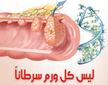 الاكياس الدهنية تحت الابط وعلاجه 20160618 291