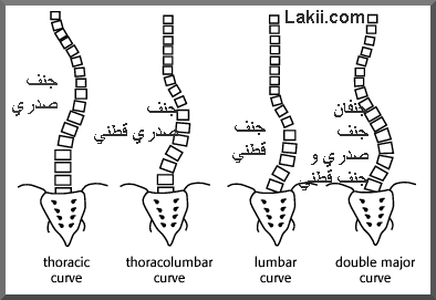 الجنف في العمود الفقري - تعريف العمود الفقري بما فيه 20160624 52