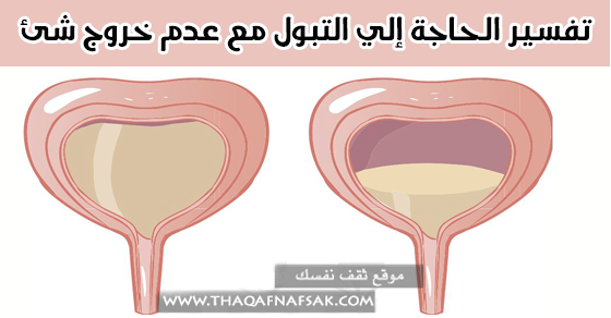 عدم القدرة على التبول - ملف كامل عن احتباس البول 20160716 15