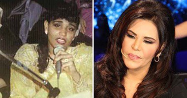 الفنانات قبل وبعد عمليات التجميل الخليجيات 120159222148