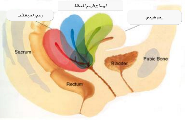 تفاصيل عن الرحم المائل 30508 1