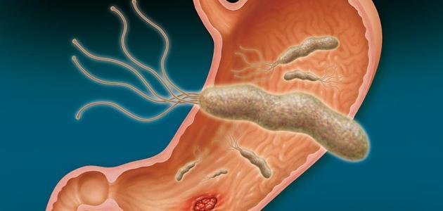 علاج جرثومة المعدة علاج جرثومة المعدة بالاعشاب و روشتة علاج - ادوية تقضي على جرثومة المعدة بجرعة واحدة 20160704 854