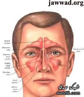 حساسية الجيوب الانفية وعلاجها بالاعشاب , افضل توليفه طبيعيه معالجه ومجربه