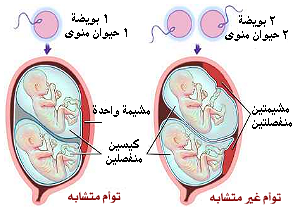 كيفية حدوث حمل التوائم - طريقة الحمل في تؤام مجربة 20160701 167