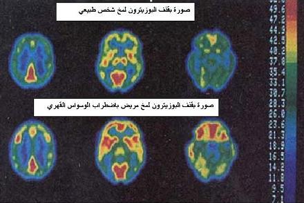 علاج اختلال الانية بالقران 20160710 1027