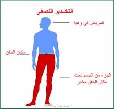 معلومات عن تخدير موضعي 20160710 2253