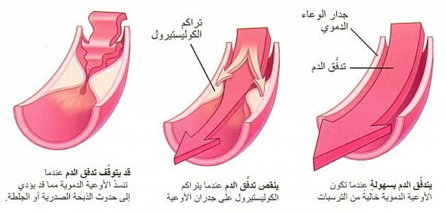 فوائد الزنجبيل للحامل والجنين 20160706 56