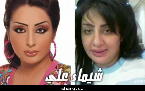 مغنيات قبل وبعد عمليات التجميل - التجميل يغير الوجه 20160719 591