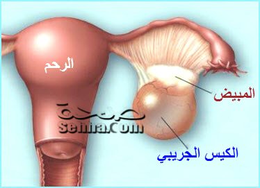 معلومات عن حويصلات المبيض - معلومات علي المدى البعيد عن حويصلات المبيض 20160703 1575