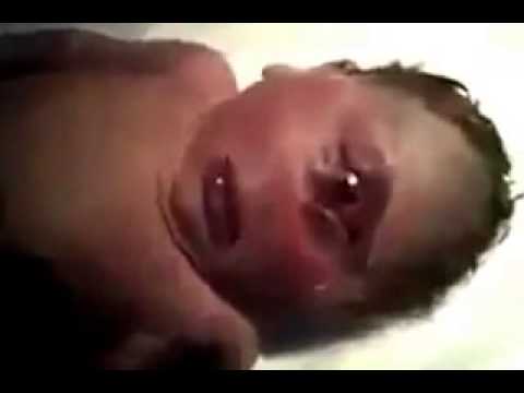 اخبار ميلاد رجل بعين واحدة - وصف شامل وموضح لهذا المقال 20160703 1721