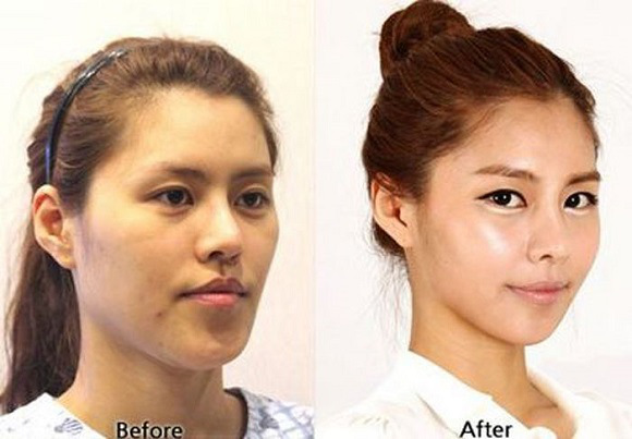 الممثلات الكوريات قبل وبعد عمليات التجميل Korean Before After 17