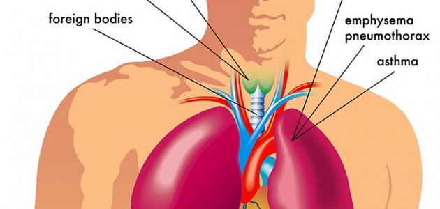 علاج ضيق التنفس والكتمه - اسعافات فوريه وفعاله لضيق التنفس اسباب ضيق التنفس