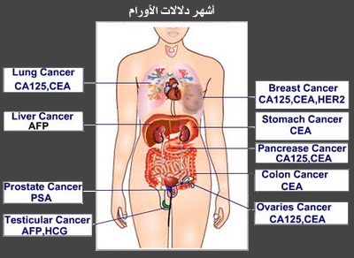 التحليل بالكامل - ما هو اختبار تحليل Ca 125 20160710 65