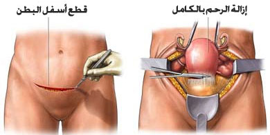 ماهي اسباب جفاف المهبل