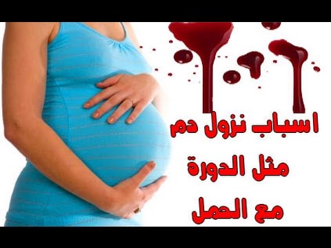 سيلان الدم اثناء الحمل 20160713 1622