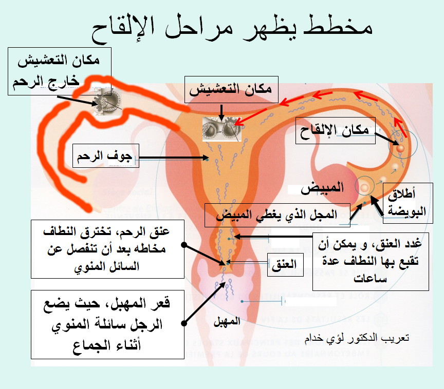 ما هو التعشيش وما اعراضه 20160712 2011