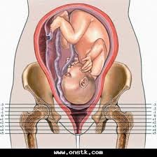نتيجة بحث الصور عن شكل البطن عند نزول راس الجنين في الحوض