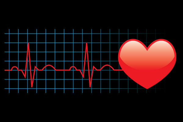 دقات القلب السريعة المفاجئة Irregular Heartbeat-Jpeg