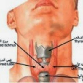 علاج الغدة الدرقية في الطب النبوي