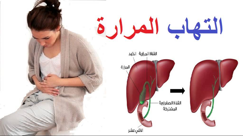 اعراض مرض المرارة وعلاجها , ازاى تفرق بين مغص المرارة والمغص العادي